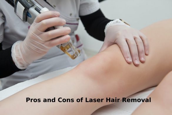 Laser Hair Removal