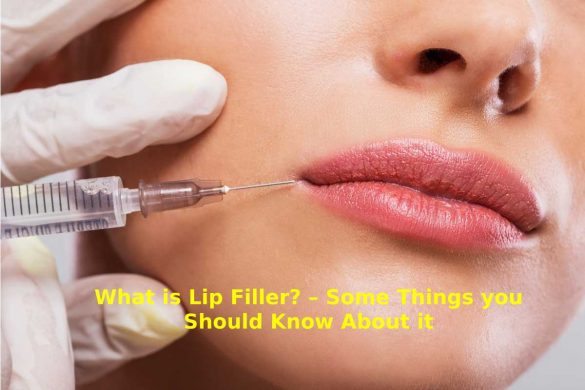 Lip Filler