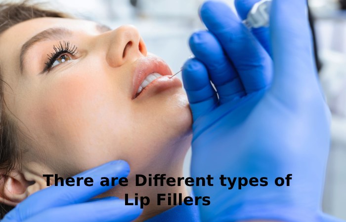 types of Lip Fillers